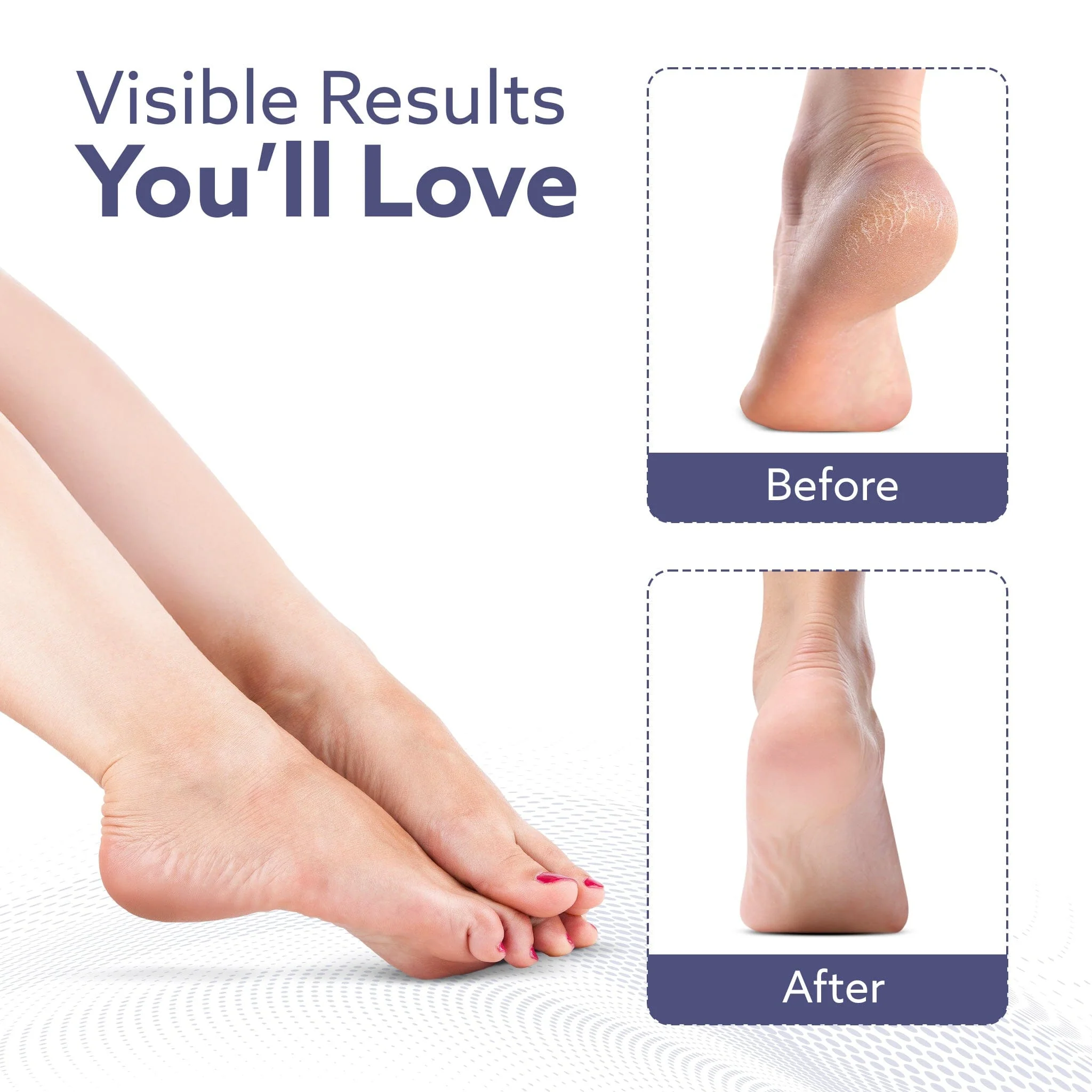 Callus Remover Replaceable Heads, 2 Pcs, Callus & Dead Skin Removal Filer, Pedicure at Home - Image 4