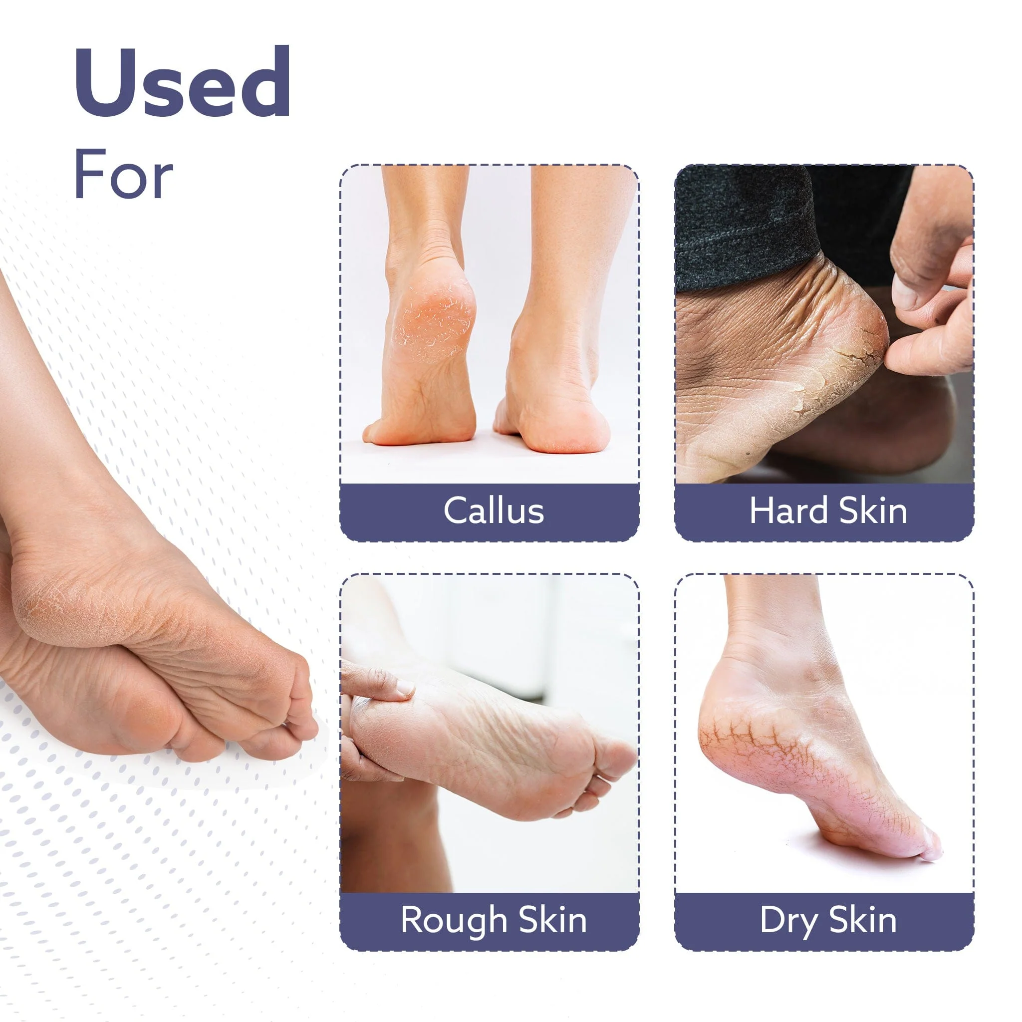 Callus Remover Replaceable Heads, 2 Pcs, Callus & Dead Skin Removal Filer, Pedicure at Home - Image 5