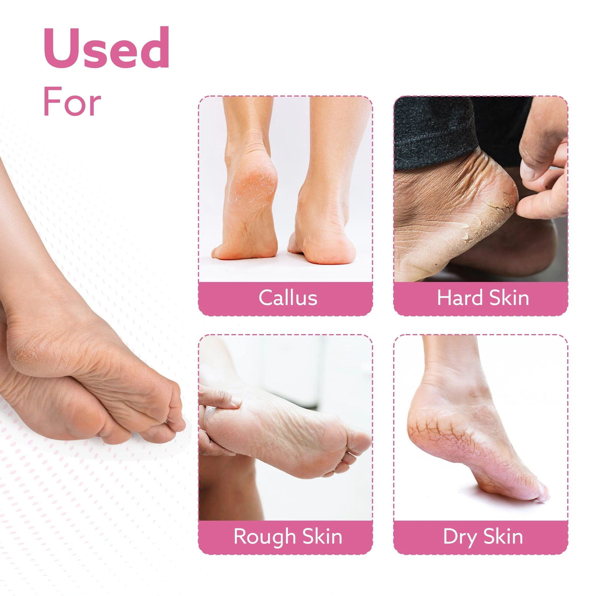 Callus Remover Replaceable Heads, 2 Pcs, Callus & Dead Skin Removal Filer, Pedicure at Home - Image 4