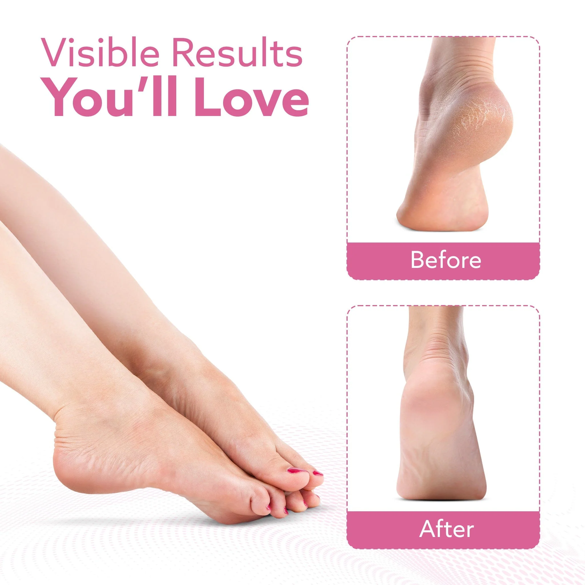 Callus Remover Replaceable Heads, 2 Pcs, Callus & Dead Skin Removal Filer, Pedicure at Home - Image 5