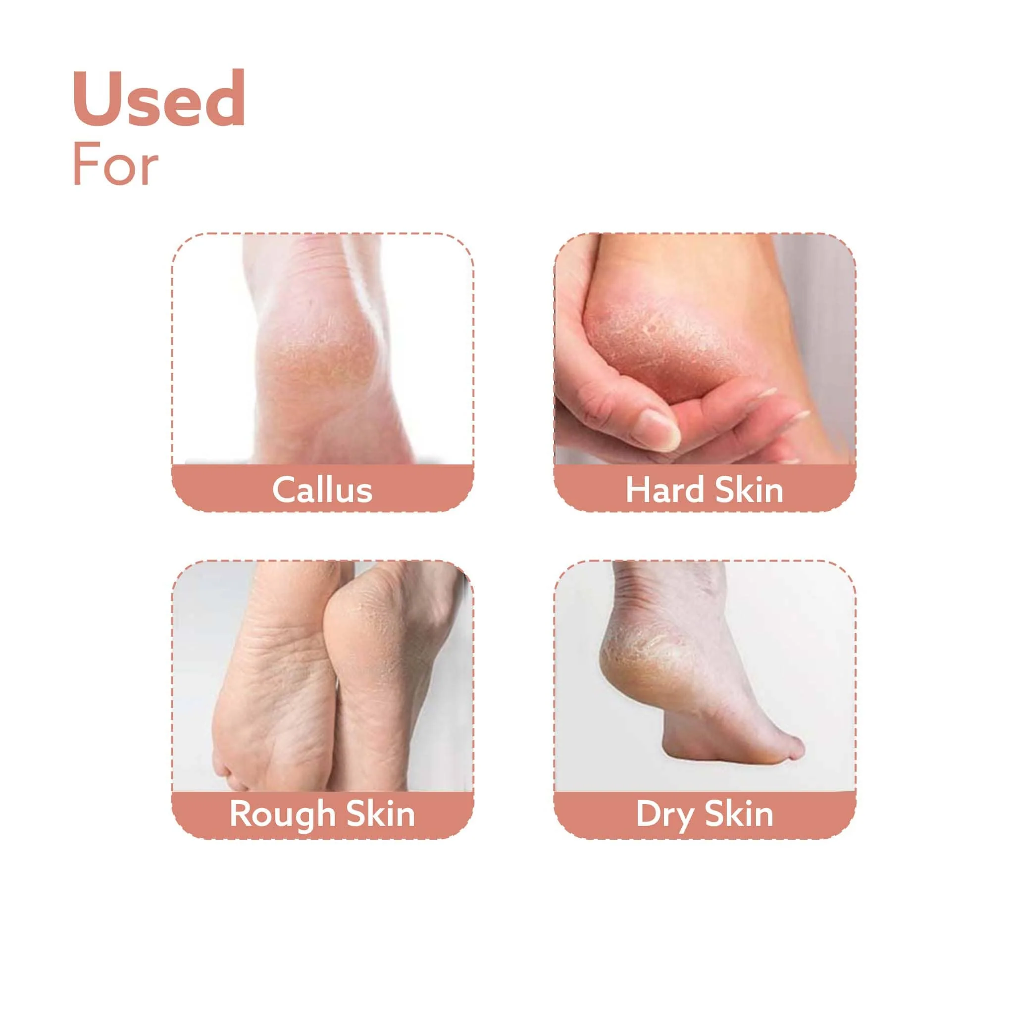 Callus Remover Replaceable Heads, 3 Pcs - Image 4