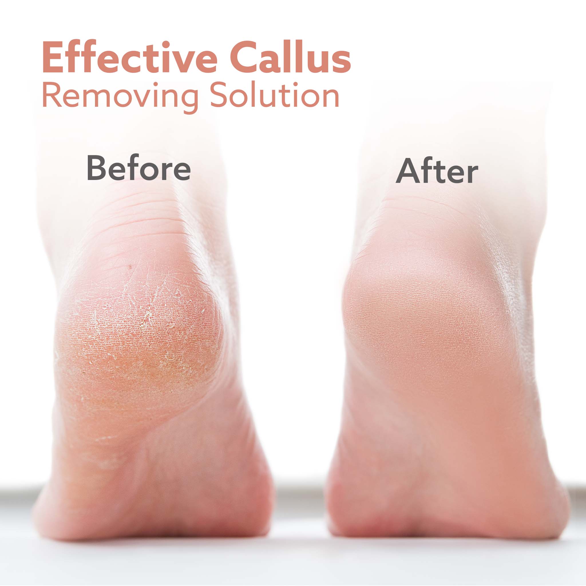 Callus Remover Replaceable Heads, 3 Pcs - Image 5
