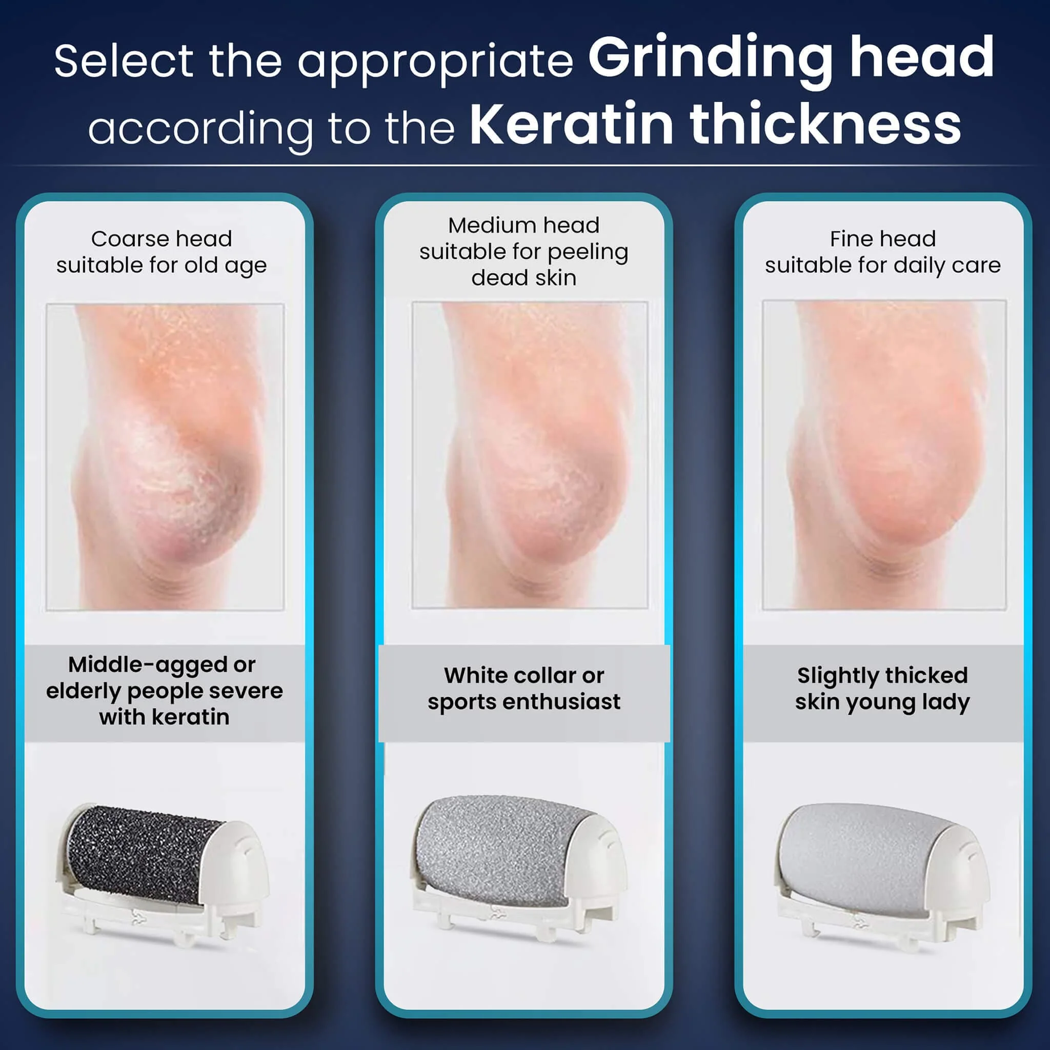 Callus Remover Replaceable heads - 3 Pcs - Image 3