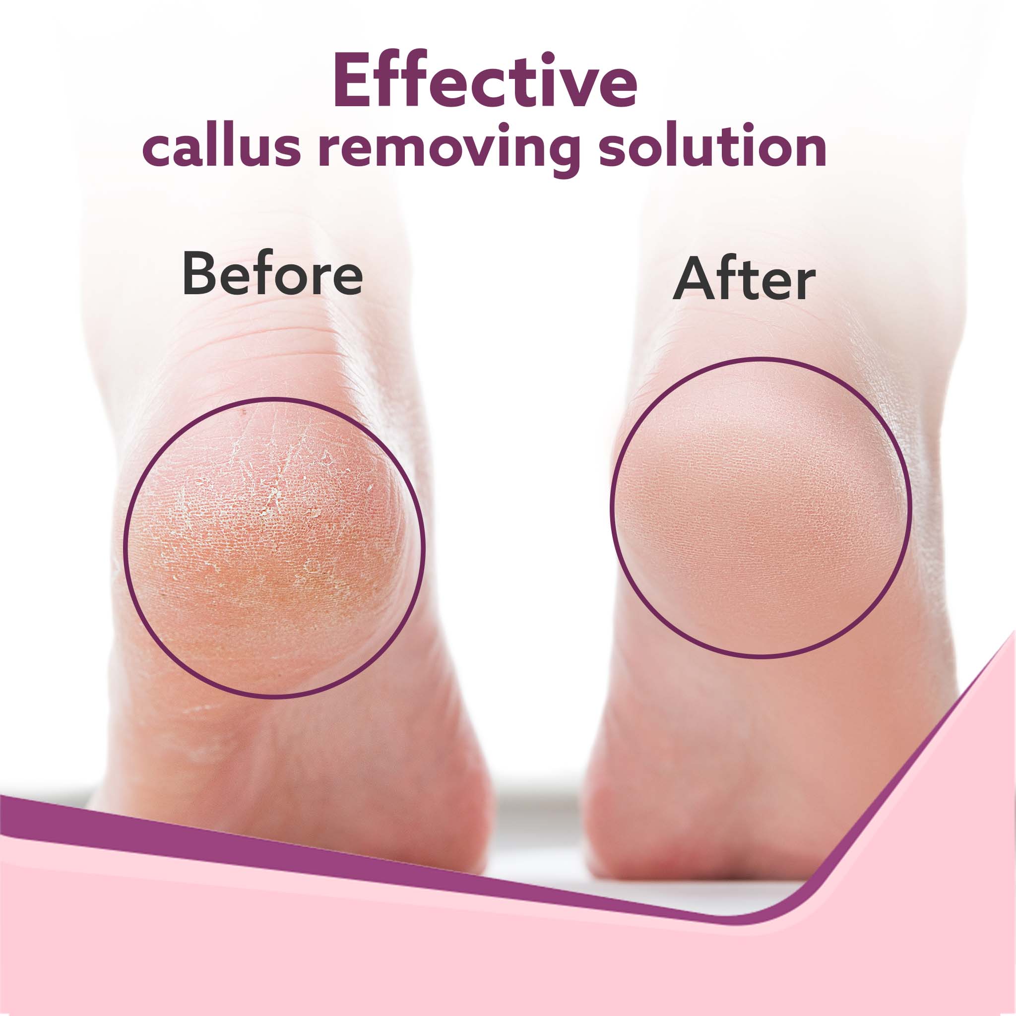 Callus Remover with 3 Interchangeable Head Rollers, Electronic Foot Scrubber For Callus & Dead Skin Removal, Pedicure Device, 2 Speed, Rechargeable Foot Care, Waterproof, CR1727, Pink - Image 5