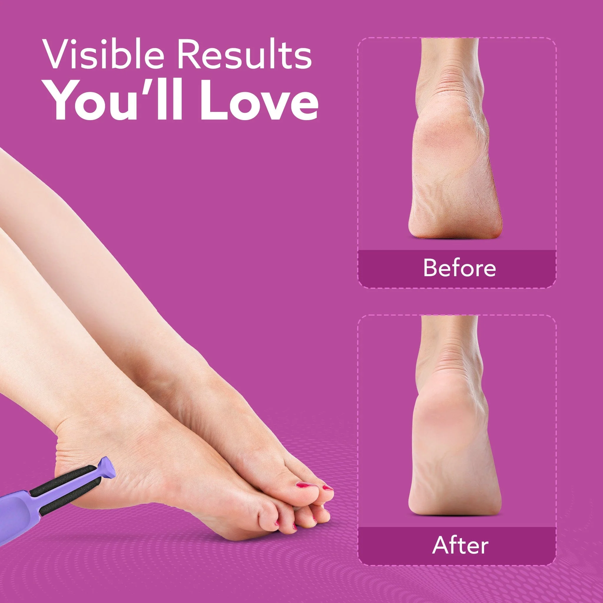 CR1414 Electric Callus Remover with 2 Replaceable Heads – Rechargeable Foot Scrubber for Dead Skin & Cracked Heels | Pedicure Machine with 120 Minutes Runtime - Image 7