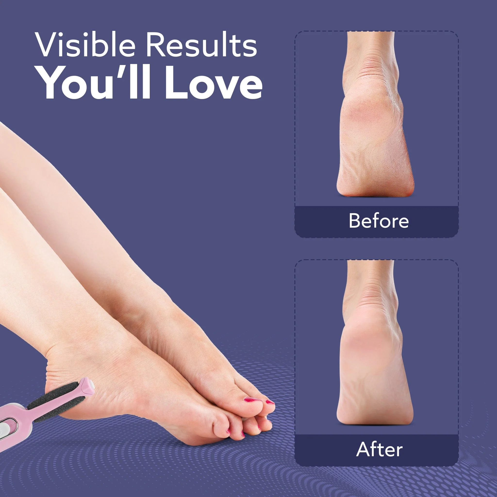 CR1717 Electric Callus Remover with 2 Replaceable Heads – Rechargeable Foot Scrubber for Dead Skin & Cracked Heels | Pedicure Machine with 120 Minutes Runtime - Image 7